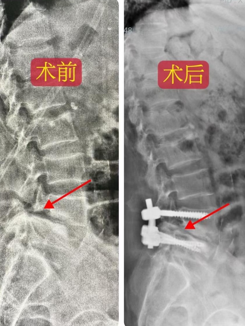 女子食用后几乎无法行走……爱吃羊的一定要警惕! 女子食用后几乎无法行走……爱吃羊的一定要警惕!