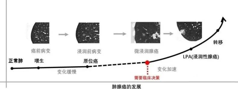 “魔术师”刘谦宣布抗癌成功，他的这个抗癌经验值得我们借鉴！