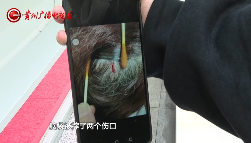 “我当时感觉很绝望...”阿姨地铁站坐扶梯不慎摔倒，到底谁来负责？