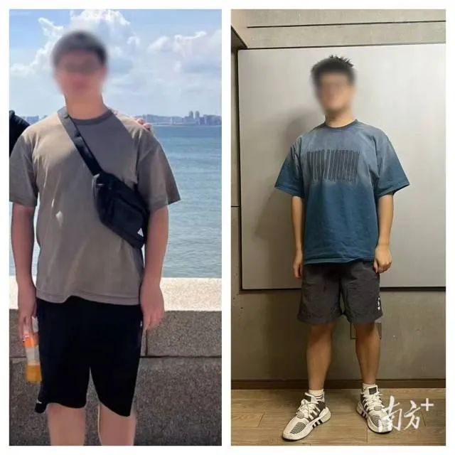 大学生减肥月瘦20斤却得了重度脂肪肝