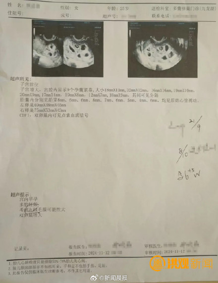 专家称9胞胎产妇或面临大月份流产，三胎或三胎以上妊娠医生建议减胎