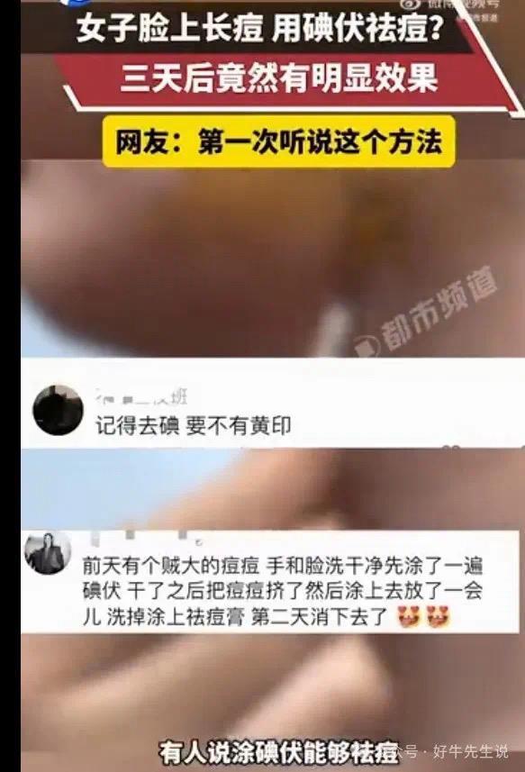 涂抹碘伏祛痘3天就见效？惊呆女大学生！皮肤科专家：可以但没必要