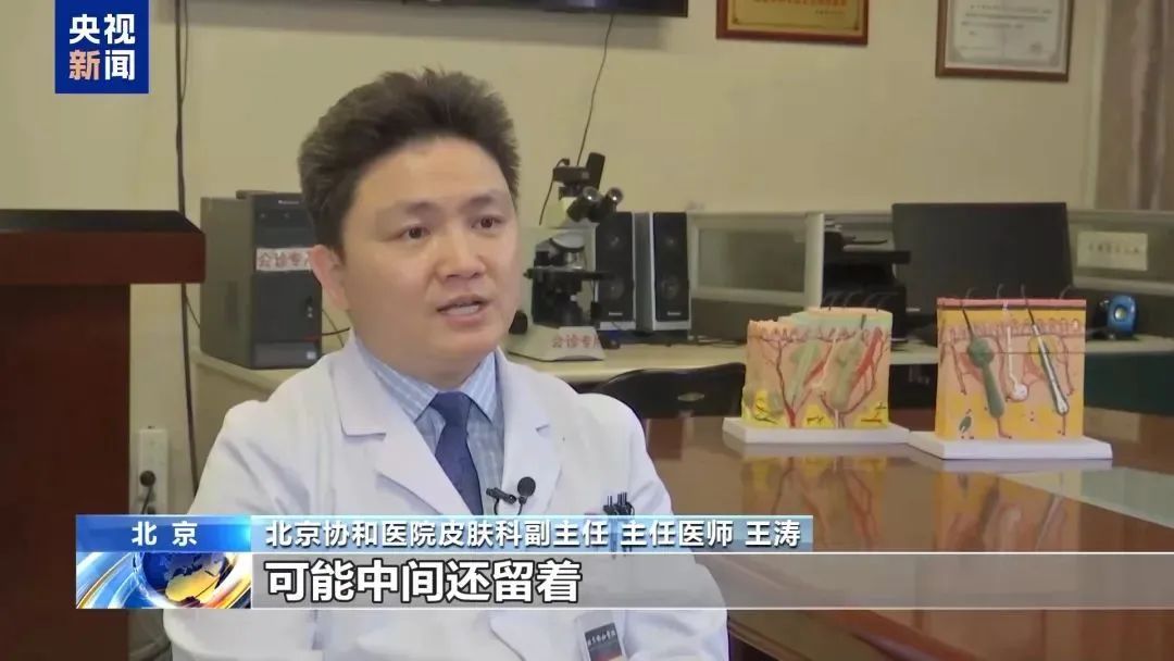 “科学”流言榜 丨发际线上移就是脱发?来看专家科学解读 “科学”流言榜 丨发际线上移就是脱发?来看专家科学解读