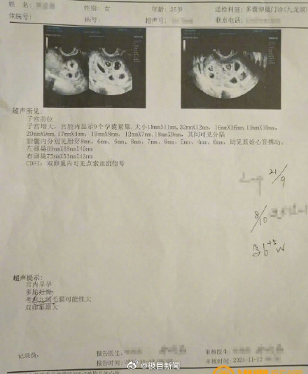 南昌一女子自然受孕怀上九胞胎 南昌一女子自然受孕怀上九胞胎