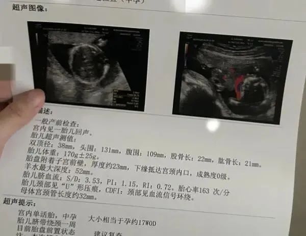 年轻女孩代孕流产,非法代孕哪有“自愿”可言? 年轻女孩代孕流产,非法代孕哪有“自愿”可言?