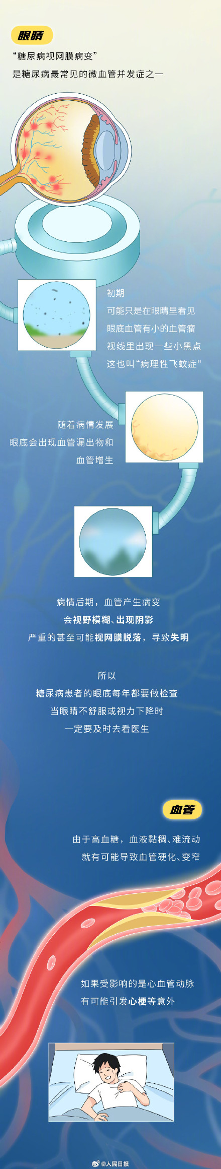 一组漫画了解：糖尿病是怎么患上的