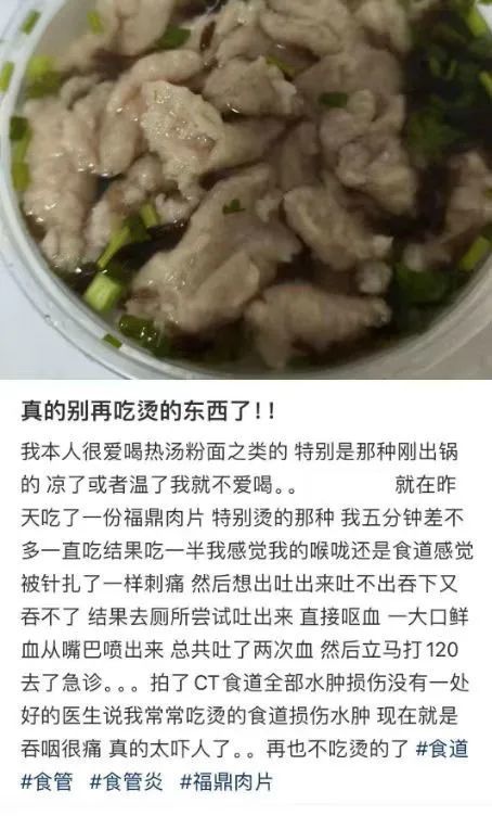 一口烫肿食管,男子吐血休克!“趁热吃”可能致癌 一口烫肿食管,男子吐血休克!“趁热吃”可能致癌