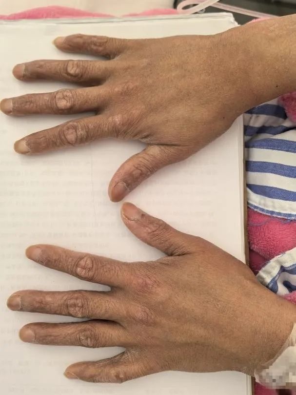 吃了它3年,35岁女子肠子都黑了!这东西几乎家家都有…… 吃了它3年,35岁女子肠子都黑了!这东西几乎家家都有……