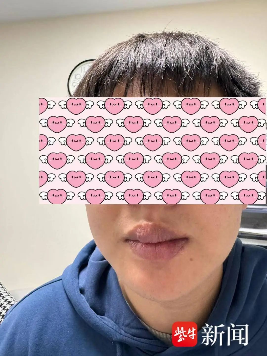 吓人！男子与爱宠“亲亲”，半个嘴唇被咬掉！