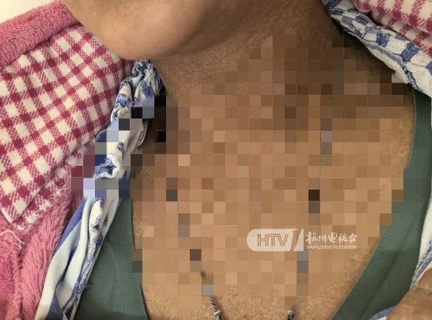 吃了它3年,35岁女子肠子都黑了!这东西几乎家家都有…… 吃了它3年,35岁女子肠子都黑了!这东西几乎家家都有……