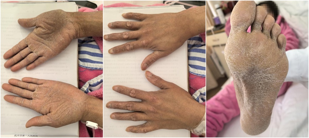 女子连吃三年牛黄解毒片“砒霜”中毒……医生紧急提醒