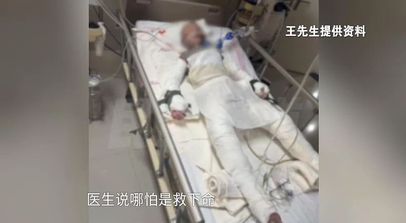 11岁男孩爬火车头遭高压电击！父母崩溃......