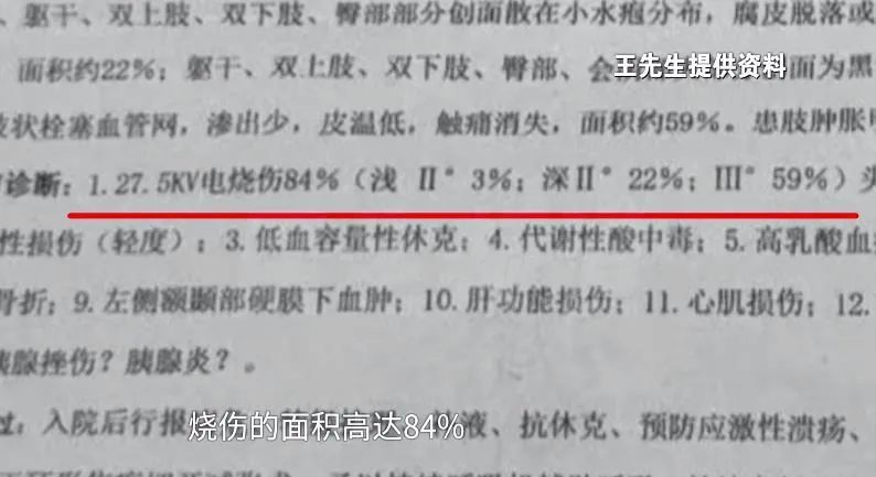 11岁男孩爬火车头遭高压电击！父母崩溃......