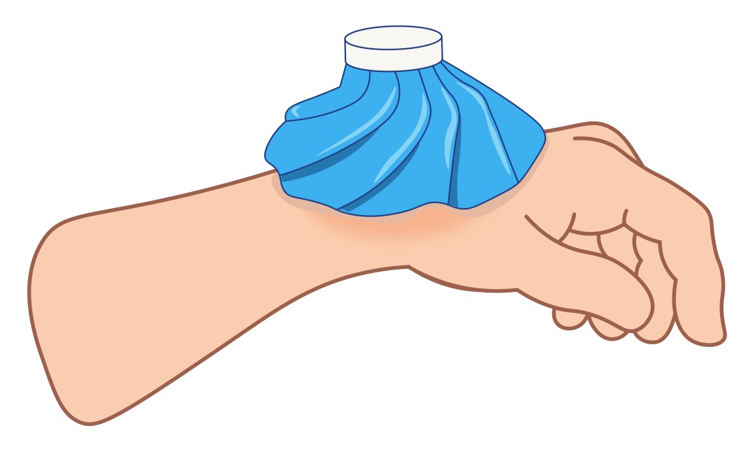 运动损伤高发季已至！肌肉拉伤？还是韧带拉伤？一文读懂！