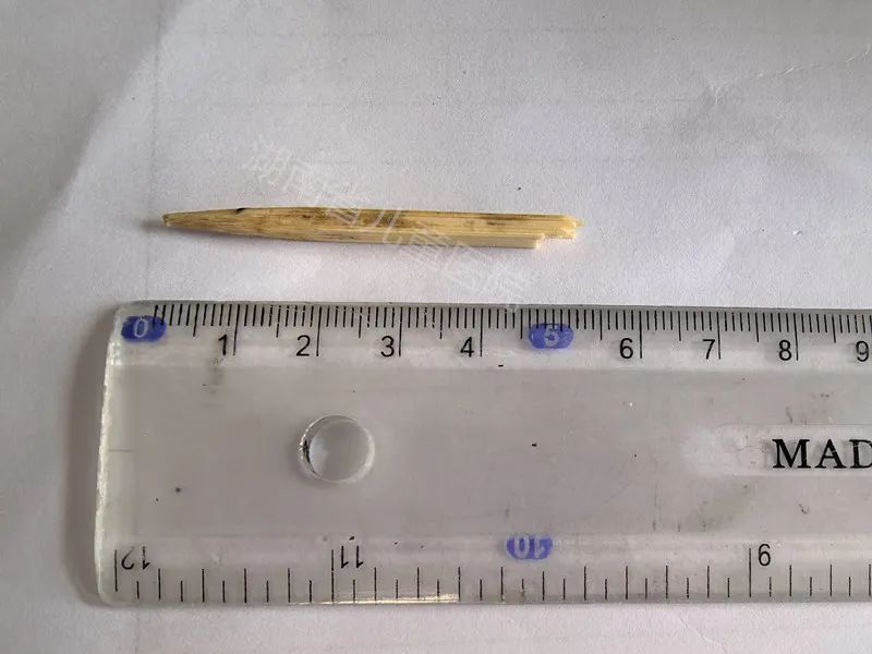 一个急刹，竹签插进2岁男童脸部……