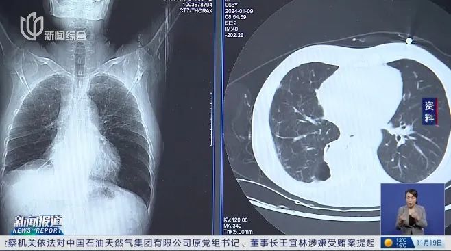 买重疾险后确诊癌症! 这个细节竟成拒赔理由…上海法院判了→