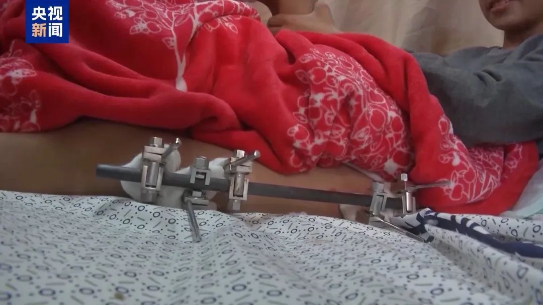 今天是世界儿童日，这些挣扎的孩子在呼救