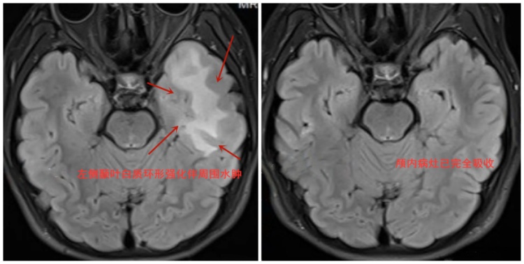 14岁少年睡梦中突发癫痫，竟因与一动物亲密接触……