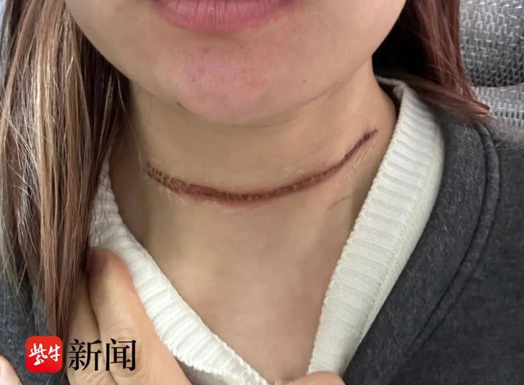 可怕！女子参加骑行比赛竟遭风筝线“割喉”，组委会称“签了免责协议”