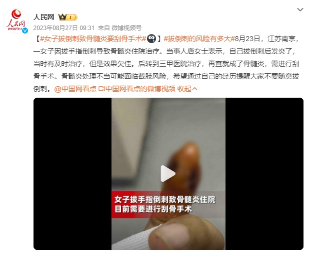 手上长“倒刺”后，这个动作很多人在做！医生提醒……