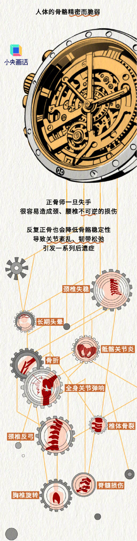 随便正骨有瘫痪风险