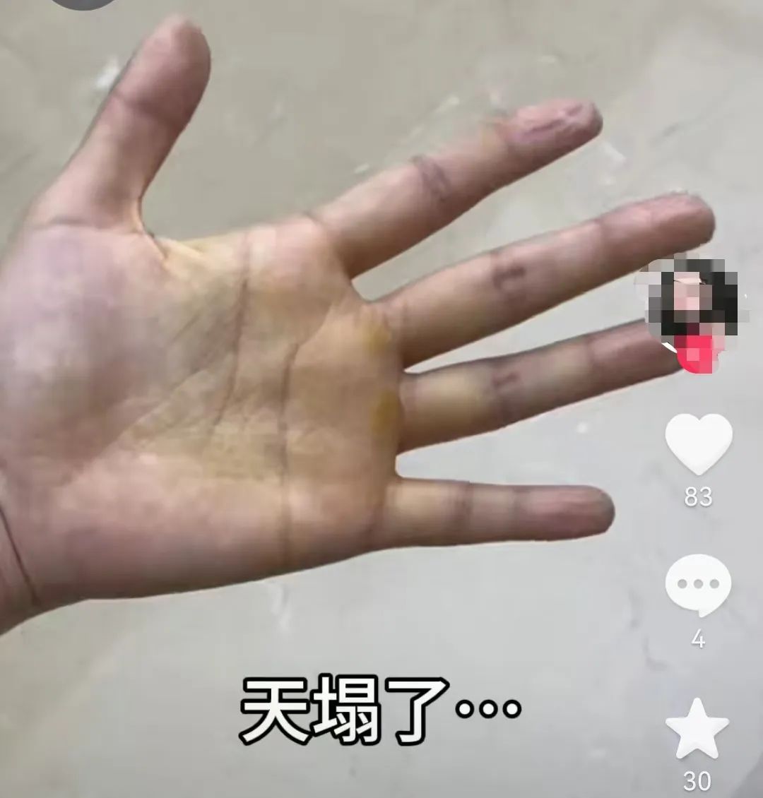 突然火了!不少福州人跟风!医生紧急提醒 突然火了!不少福州人跟风!医生紧急提醒