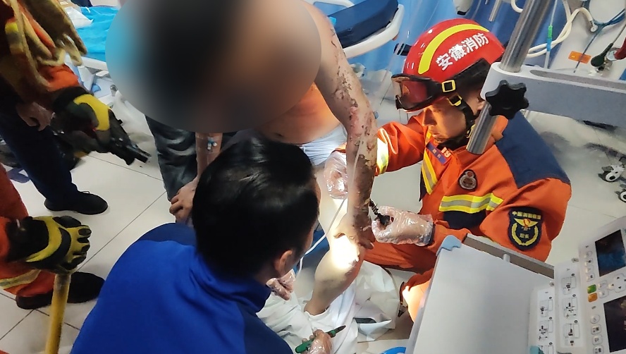 男子遭电击身上大面积烧伤！119前往医院……