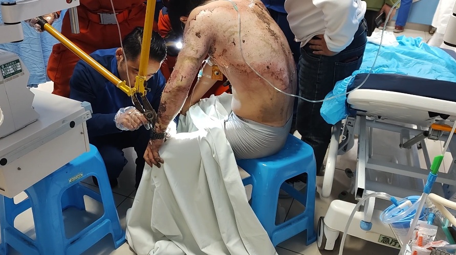 男子遭电击身上大面积烧伤！119前往医院……