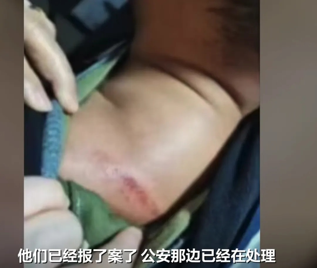 邓某（男，75岁），被采取刑事强制措施！