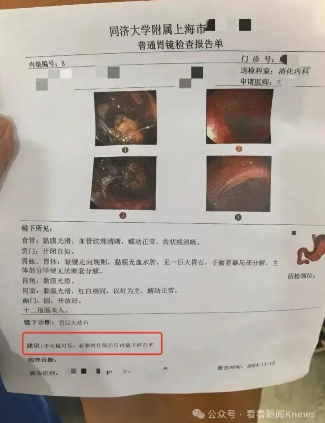 山姆超市又出事!紧急送往医院 山姆超市又出事!紧急送往医院