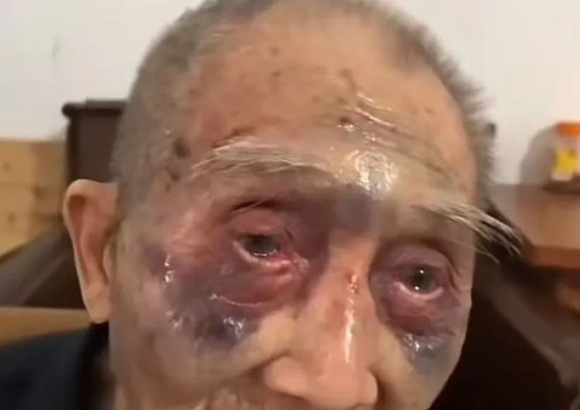 触目惊心!90多岁老人遭养老院护工殴打近一年?官方回应 触目惊心!90多岁老人遭养老院护工殴打近一年?官方回应