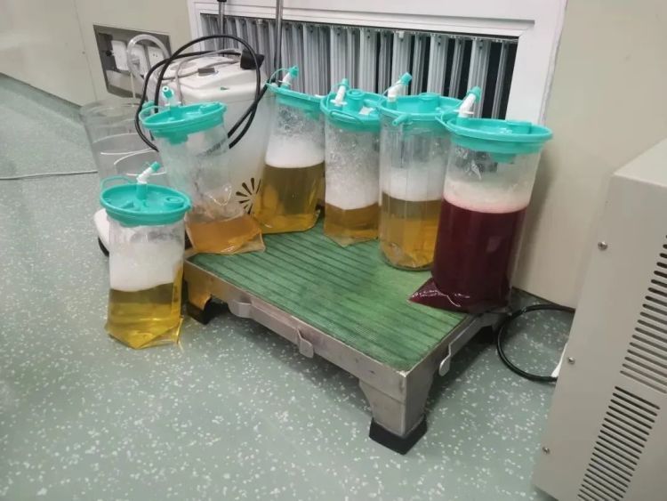 13岁女孩长胖20斤，罪魁祸首竟是它！河北省儿童医院提醒