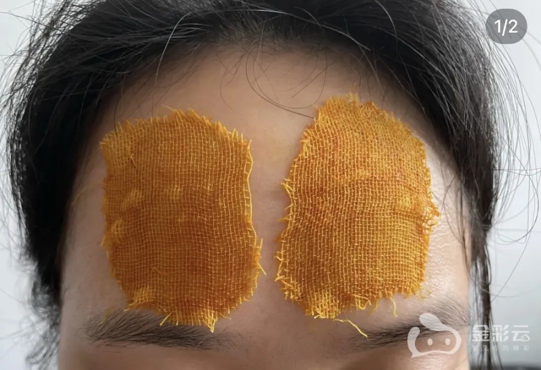 突然爆火！有人跟风尝试！医生紧急提醒：别乱来！