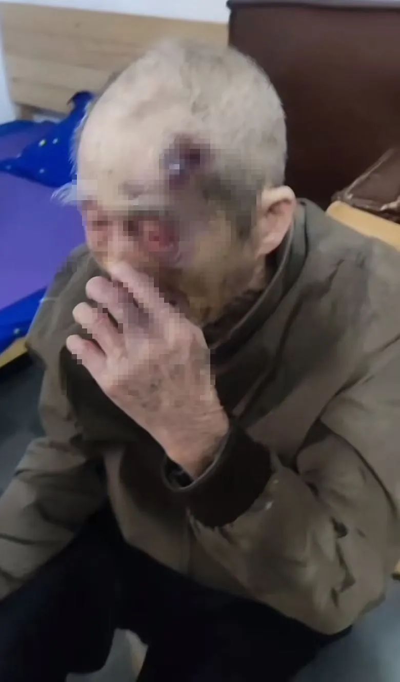 触目惊心!90多岁老人遭养老院护工殴打近一年?官方回应 触目惊心!90多岁老人遭养老院护工殴打近一年?官方回应