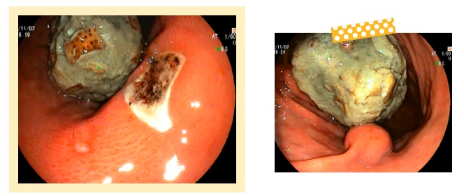 山姆超市又出事!紧急送往医院 山姆超市又出事!紧急送往医院