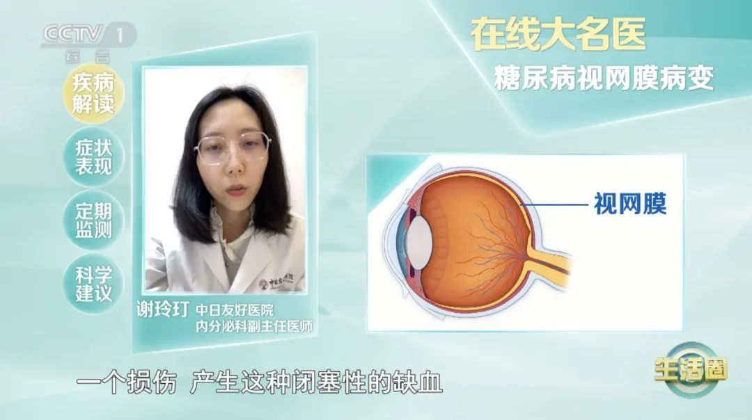 血脂、血糖高不高，“看眼”就知道，这样做帮你把它们稳住