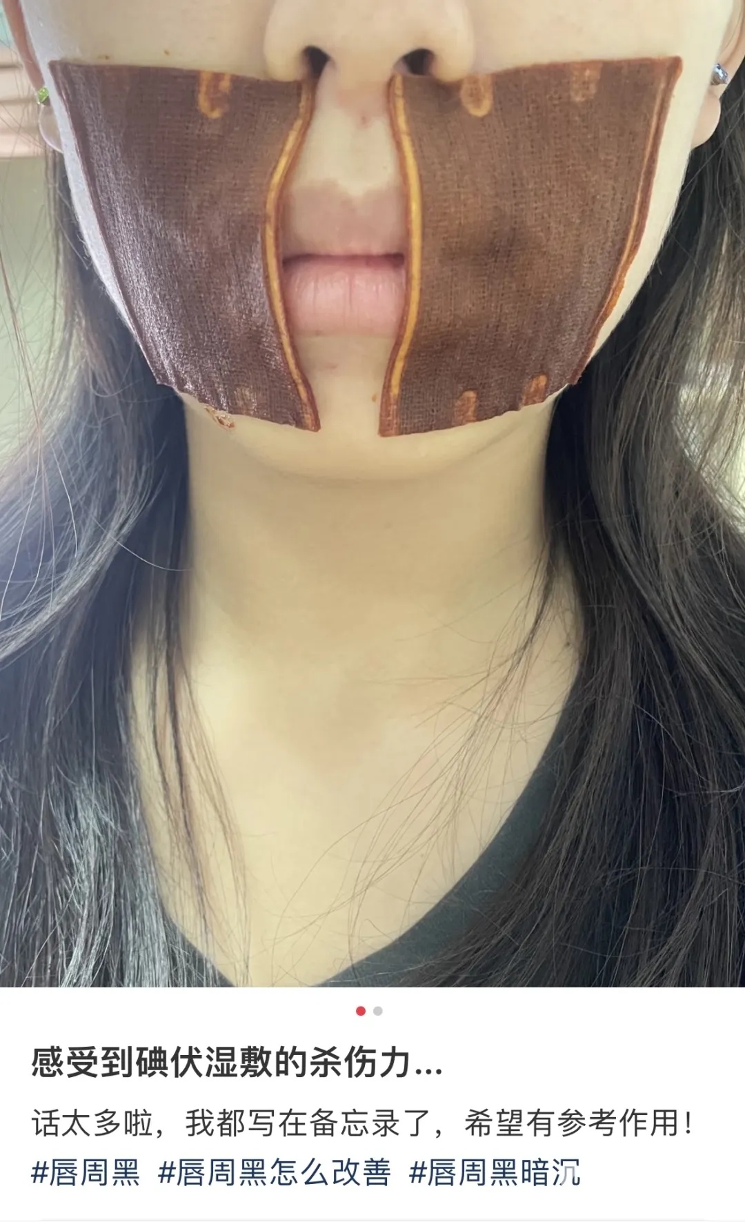 突然爆火！爱美女孩跟风尝试！医生紧急提醒