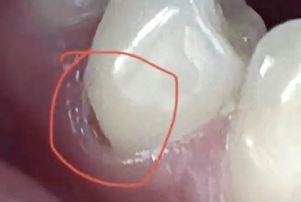 今天起,刷牙请务必调整一下! 今天起,刷牙请务必调整一下!