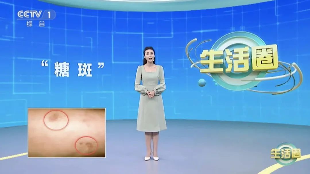 血脂、血糖高不高，“看眼”就知道，这样做帮你把它们稳住