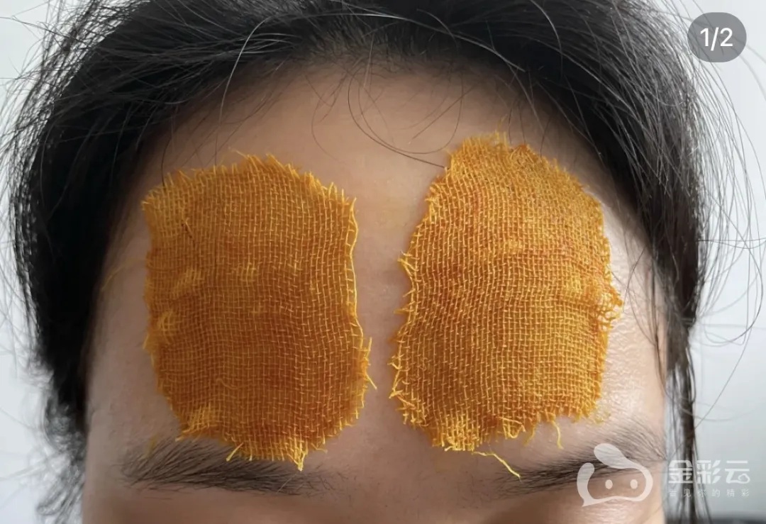 突然爆火！爱美女孩跟风尝试！医生紧急提醒