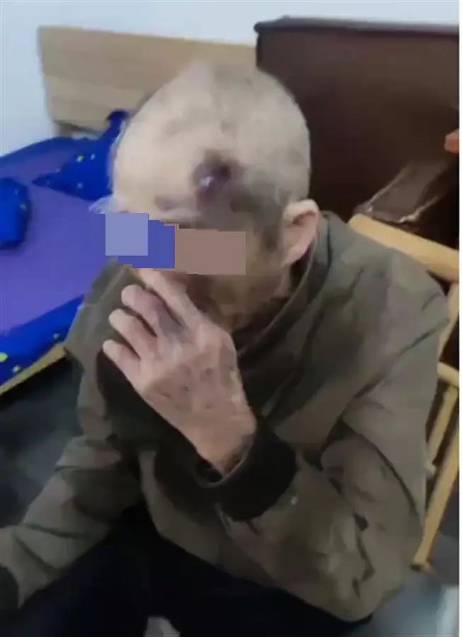 89岁老人疑遭养老院护工殴打？官方通报：摔倒受伤，排除他人殴打