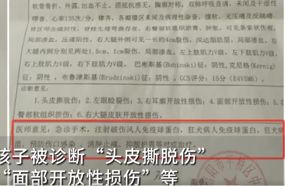 痛心！3岁男孩被烈性犬撕咬，头部缝了30多针！事发21天没找到狗主人