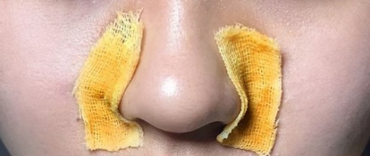 别乱涂、别乱用！紧急叫停！几乎家家必备