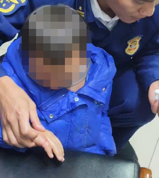 心疼!男孩手指卡一星期,发现时已深嵌肉里…… 心疼!男孩手指卡一星期,发现时已深嵌肉里……