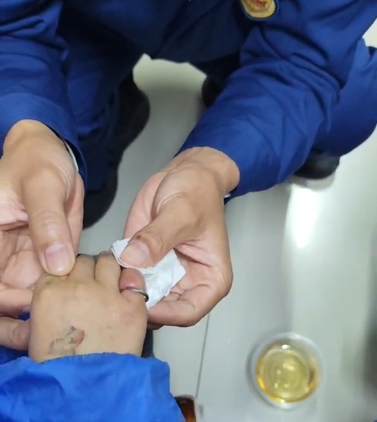 心疼!男孩手指卡一星期,发现时已深嵌肉里…… 心疼!男孩手指卡一星期,发现时已深嵌肉里……