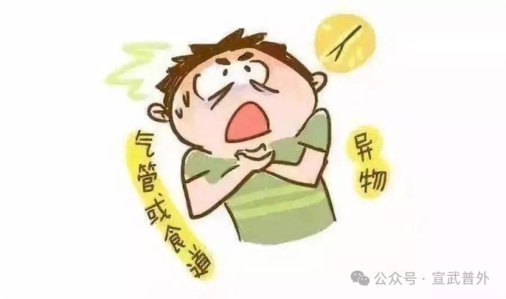 异物卡喉怎么办？