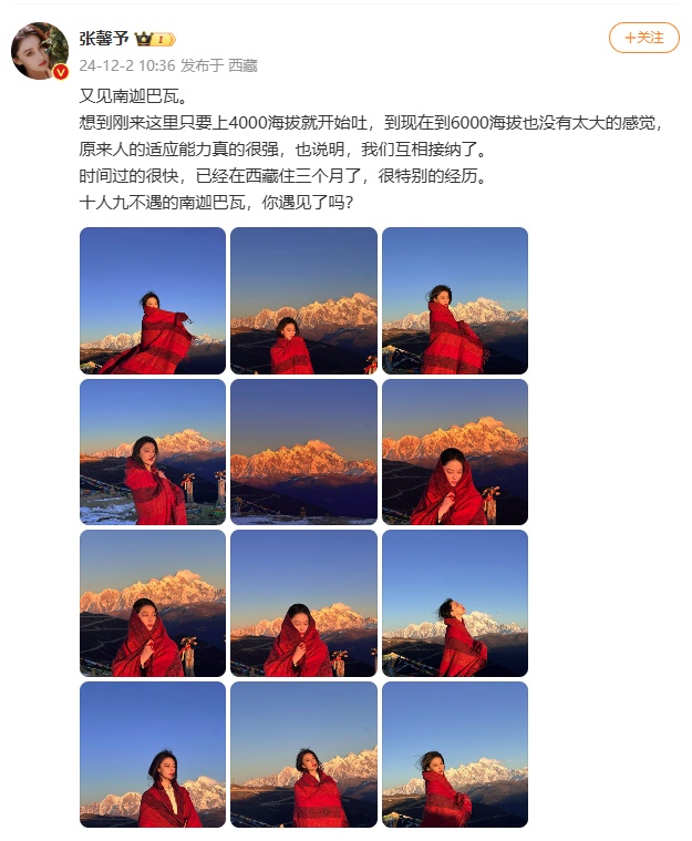 女星张馨予回应斑秃：好多了