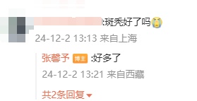 女星张馨予回应斑秃：好多了