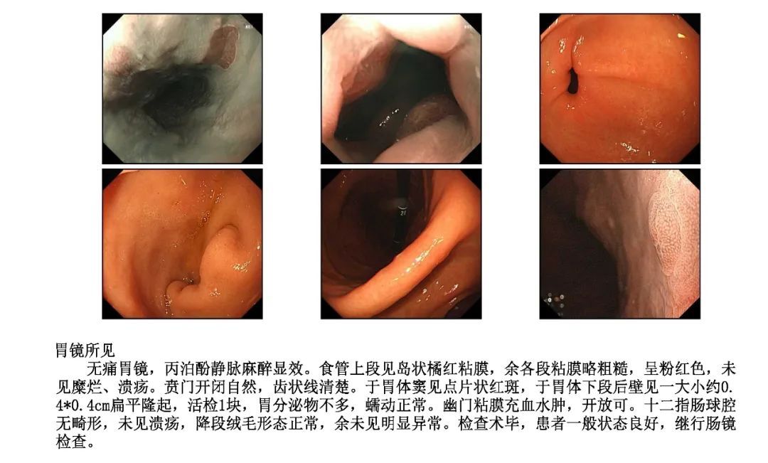 器官被严重腐蚀!浙江一女子每天喝,出问题了…很多人都这样喝 器官被严重腐蚀!浙江一女子每天喝,出问题了…很多人都这样喝