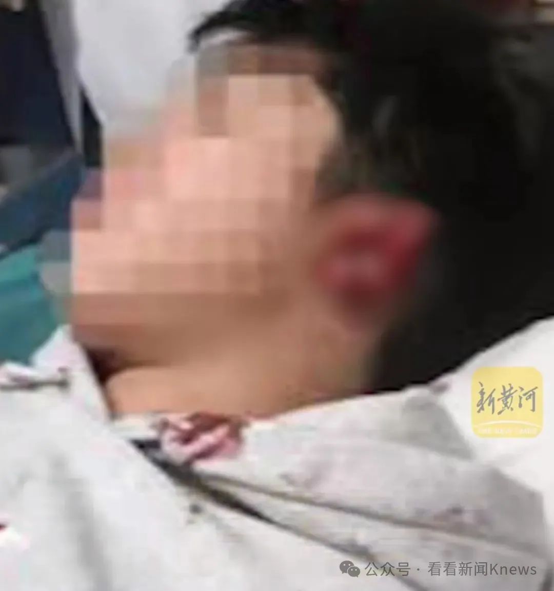 酒后咬伤学生耳朵 重庆一老师被处拘留10日 撤销教师资格